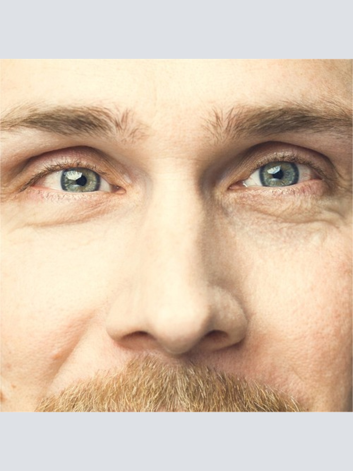 CD, Album, Ltd Kowsky - Blinder Fleck