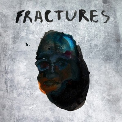 CD, EP Fractures (2) - Fractures